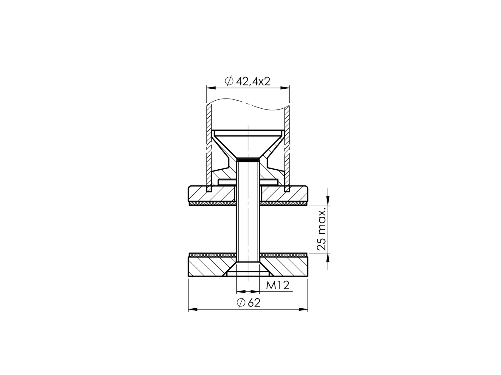 Upper anchoring - gradual
